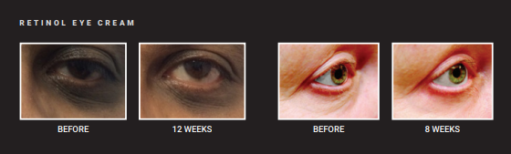 Advanced Retinol Eye Repair