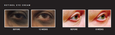 Advanced Retinol Eye Repair